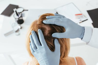 klinikte hastanın saç inceleyen mavi lateks eldiven dermatolog havai görünümü 