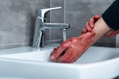 lavaboda kanayan elleri yıkayan adamın kısmi görünümü