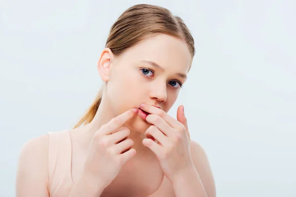 Verärgertes Teenager Mädchen Mit Hautproblem Isoliert Auf Grau — Stockfoto