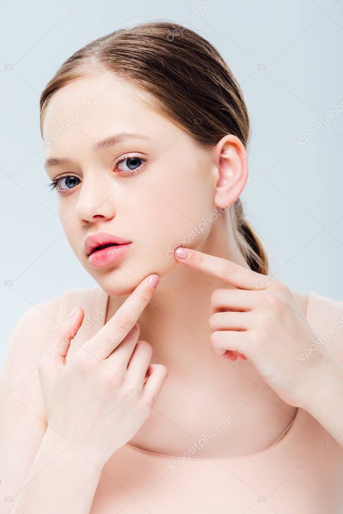 displeased teenage girl having acne on face isolated on grey