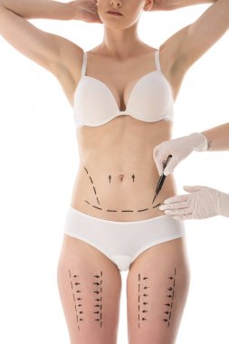 partial view of plastic surgeon in latex gloves making marks on body isolated on white clipart