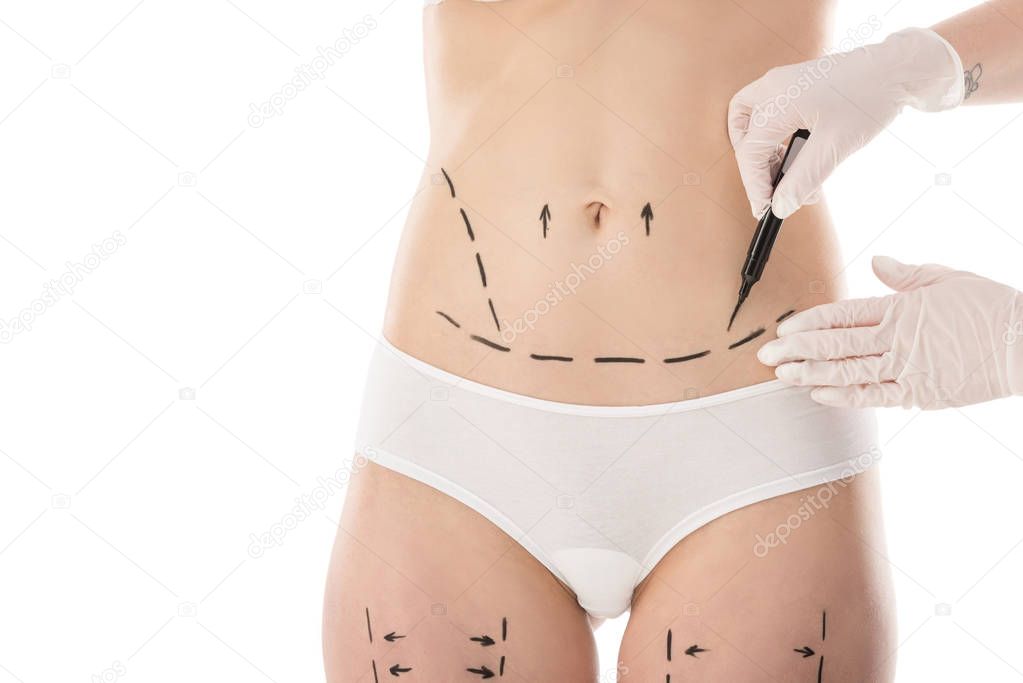 partial view of plastic surgeon in latex gloves making marks on body isolated on white