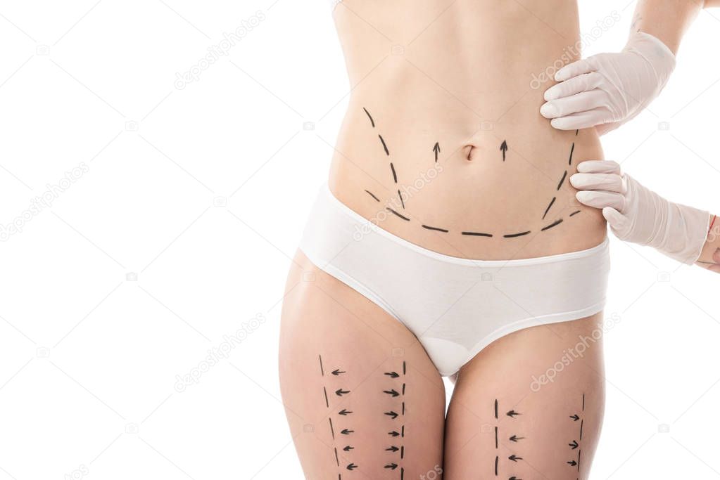 partial view of plastic surgeon in latex gloves and patient in underwear with marks on body isolated on white