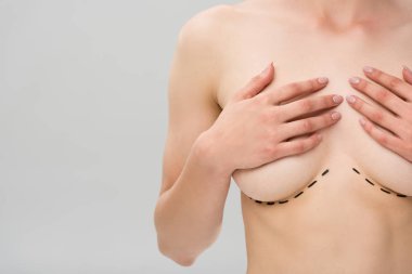 partial view of naked woman with marks under breast isolated on grey clipart