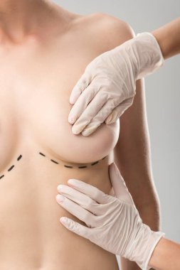 lateks eldivenplastik cerrah kısmi görünümü ve gri izole meme altında işaretleri ile hasta