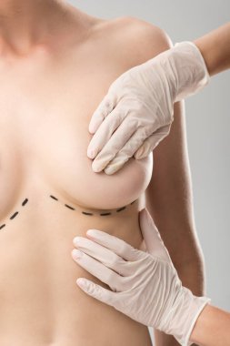 partial view of plastic surgeon in latex gloves and patient with marks under breast isolated on grey clipart