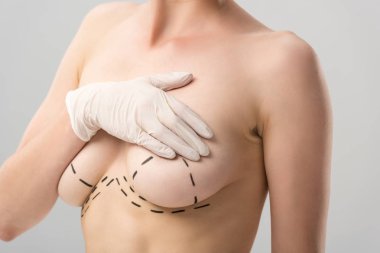 cropped view of woman in latex glove with marks on breast isolated on grey clipart
