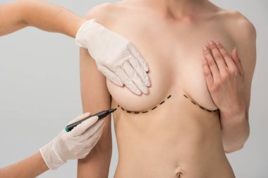 cropped view of plastic surgeon in latex gloves making marks on breast isolated on grey clipart