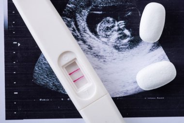 close up of pills and pregnancy test on ultrasound image  clipart