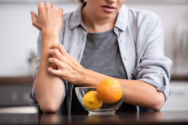 Vista Ritagliata Donna Graffiare Mano Vicino Ciotola Vetro Con Frutti — Foto Stock