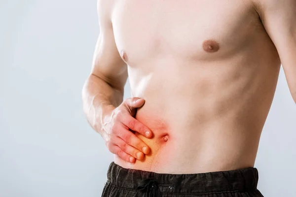 Cropped View Shirtless Sportman Abdominal Pain Isolated Grey — Stock Photo, Image