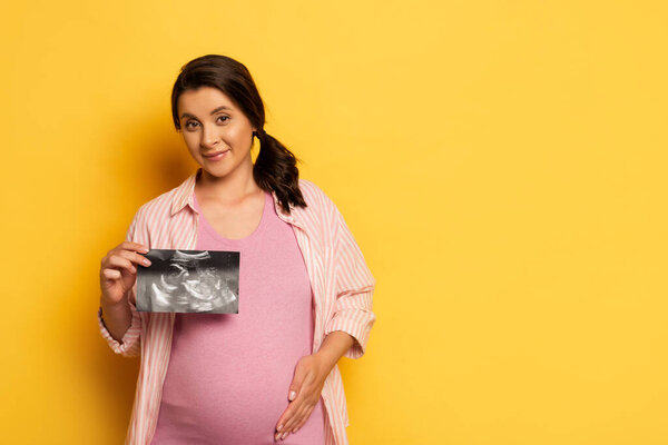 pregnant woman showing ultrasound scan while touching belly on yellow  