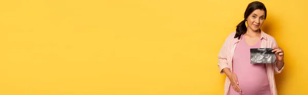 Горизонтальне Зображення Вагітної Жінки Показує Ультразвукове Сканування Торкаючись Животика Жовтому — стокове фото