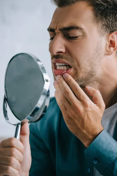 Jeune homme avec mal de dents regardant miroir — Photo de stock