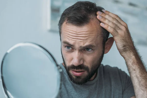 Uomo di mezza età sconvolto con alopecia guardando allo specchio, concetto di perdita di capelli — Foto stock