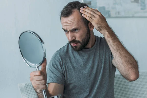 Homem de meia idade barbudo com alopecia olhando para o espelho, conceito de perda de cabelo — Fotografia de Stock