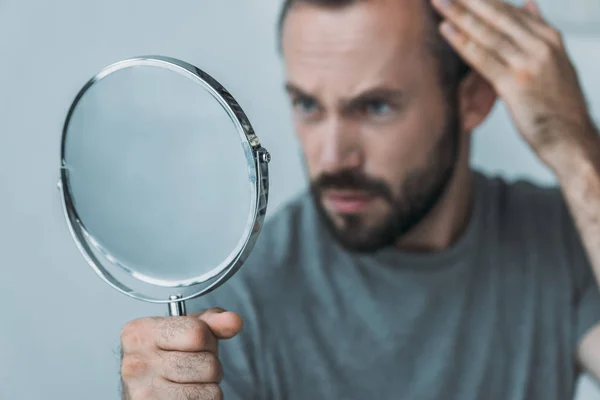Primer plano vista de barbudo hombre adulto medio con alopecia mirando el espejo, concepto de pérdida de cabello - foto de stock