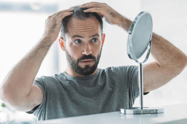 Barbudo hombre adulto medio con alopecia mirando el espejo, concepto de pérdida de cabello - foto de stock