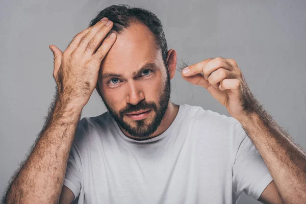Bearded middle aged man holding fallen hair and looking at camera isolated on grey — Stock Photo
