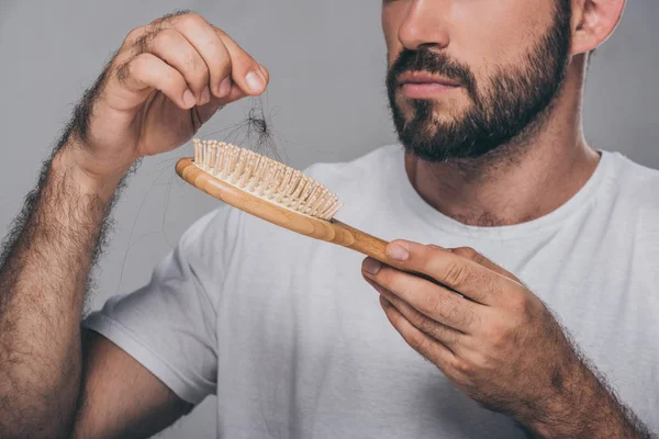 Abgeschnittene Aufnahme eines bärtigen Mannes mit Haarbürste, Haarausfall-Konzept — Stockfoto