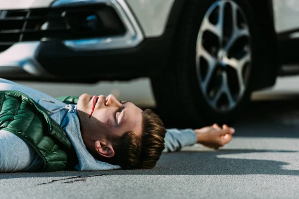 Side view of injured young man lying on road after traffic collision — Stock Photo