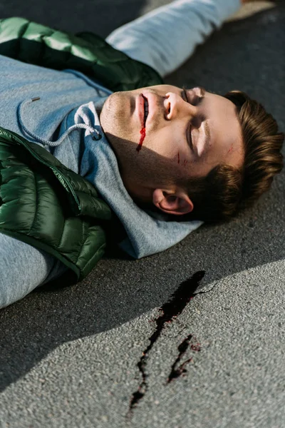 Close-up view of injured young man on road after traffic accident — Stock Photo