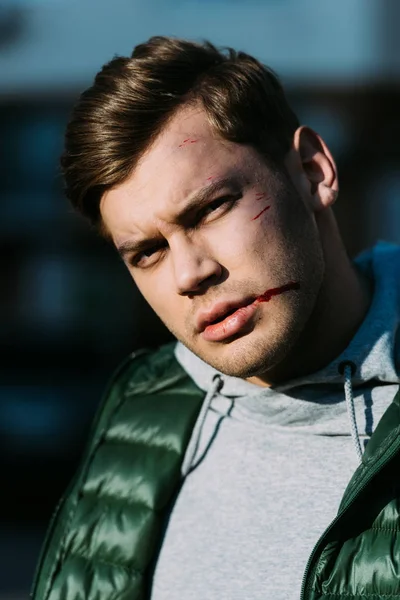 Injured man with blood on face looking at camera after traffic collision — Stock Photo