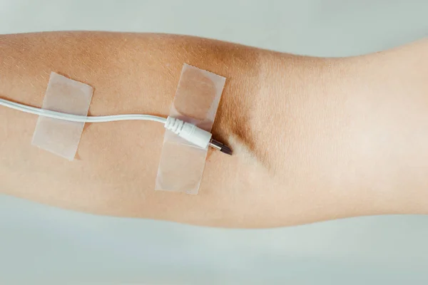 Close up da mão feminina com cabo branco anexado como infusão IV médica isolada em cinza, conceito de música — Fotografia de Stock