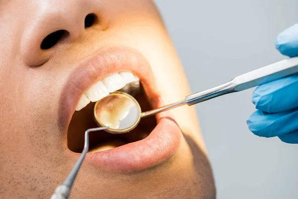 Vue recadrée de l'homme afro-américain avec bouche ouverte pendant le check-up — Photo de stock