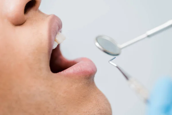 Vista cortada do homem americano africano com boca aberta durante check-up na clínica odontológica — Fotografia de Stock