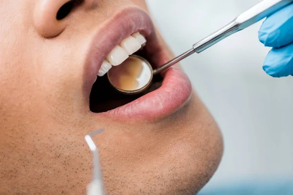 Visão cortada do homem afro-americano com instrumento médico em boca aberta — Fotografia de Stock