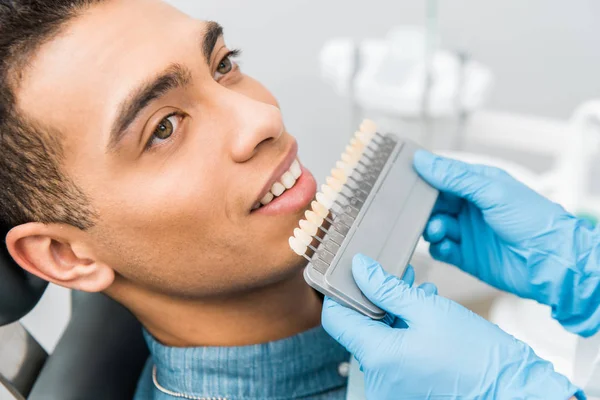 Close up of handsome african american man smiling near teeth color palette — Stock Photo