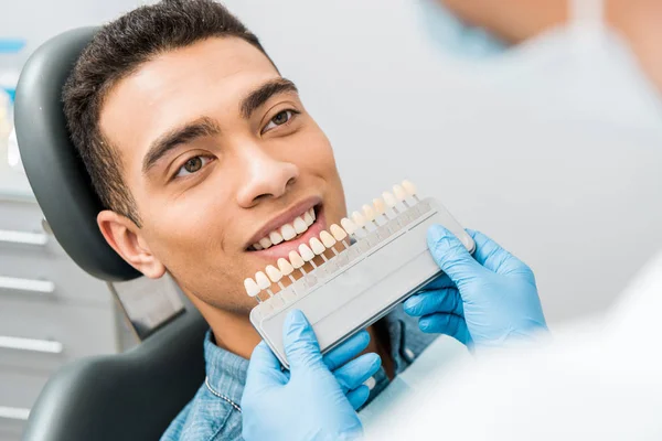 Primer plano del hombre afroamericano guapo sonriendo cerca de los dientes paleta de colores antes del procedimiento de blanqueamiento - foto de stock