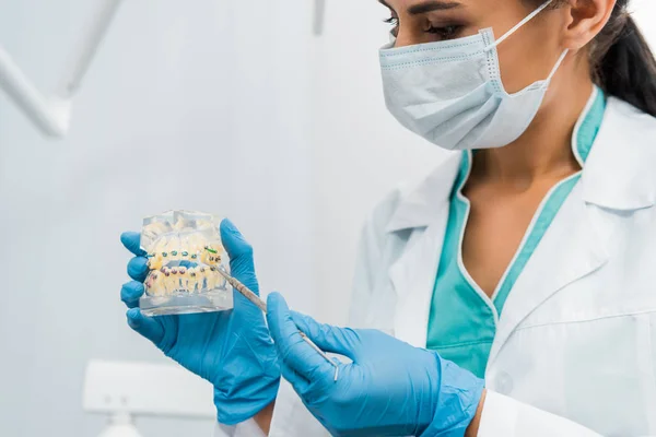 Estomatóloga en máscara que muestra modelo de mandíbula dental con aparatos ortopédicos - foto de stock