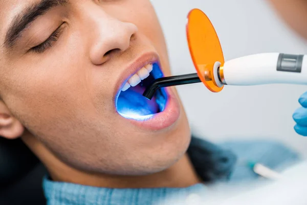 Close up of african american man during whitening procedure — Stock Photo
