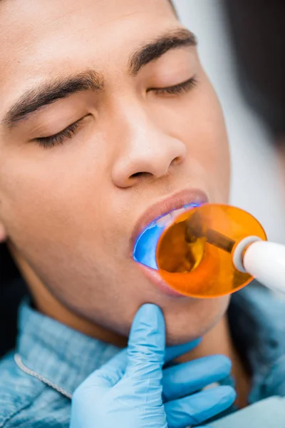 Close up of handsome african american man during whitening procedure — Stock Photo