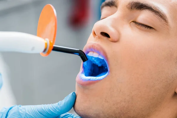 Close up of african american man during bleaching procedure — Stock Photo