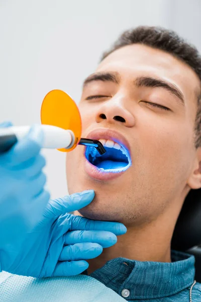 Close up of handsome african american man with open mouth during whitening procedure — Stock Photo