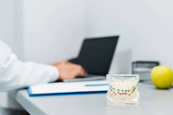 Enfoque selectivo del modelo de mandíbula dental con aparatos ortopédicos cerca de manzana - foto de stock