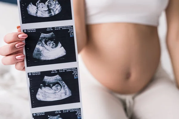 Vista cortada da mulher grávida mostrando ultra-som — Fotografia de Stock