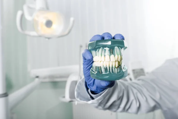 Обрезанный вид стоматолога в латексной перчатке с моделью зубов — стоковое фото
