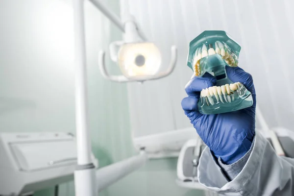 Vista recortada del dentista en guante de látex con dientes modelo en la mano - foto de stock