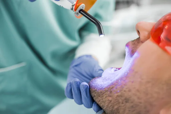 Primer plano del dentista que realiza el procedimiento de blanqueo al paciente - foto de stock