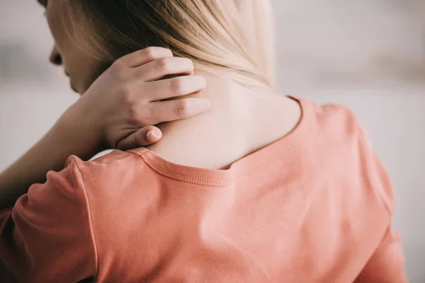 Vista posterior de la mujer rascarse el cuello mientras tiene alergia - foto de stock