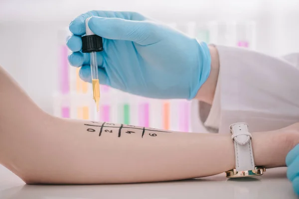 Vista recortada del médico en guantes de látex que sostiene la pipeta con líquido cerca de la mano femenina marcada - foto de stock