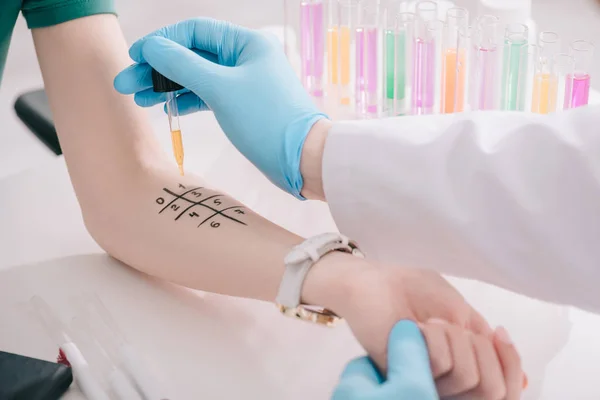 Vista recortada del médico en guantes de látex sosteniendo la pipeta con líquido cerca de la mano femenina - foto de stock