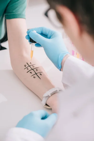 Enfoque selectivo del médico en guantes de látex sosteniendo la pipeta con líquido cerca de la mano femenina - foto de stock