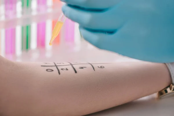 Selective focus of female hand near pipette with liquid in hand of doctor in latex glove — Stock Photo