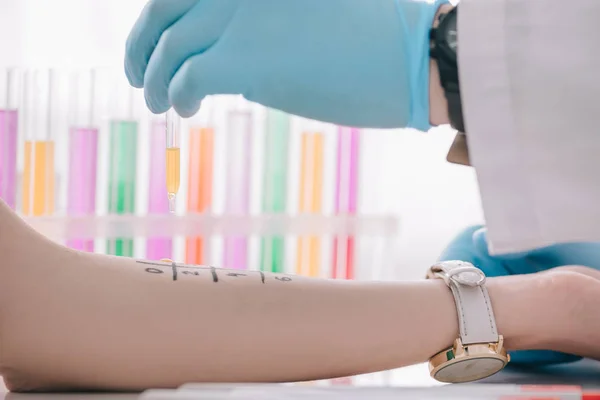Foco selectivo de mano femenina marcada cerca de la pipeta con líquido en la mano del médico en guante de látex - foto de stock