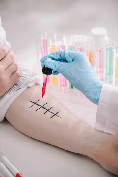 Cropped view of doctor in latex glove holding pipette near marked male hand in laboratory — Stock Photo